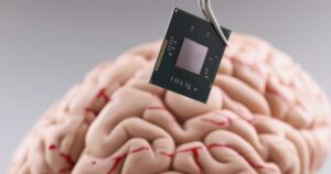 china-primeiro-chip-cerebral-pacientes-paralisia