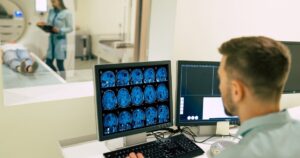 ia-identifica-avanco-alzheimer-ressonancia-magnetica